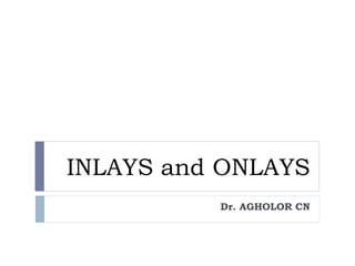 INLAYS and ONLAYS
Dr. AGHOLOR CN
 