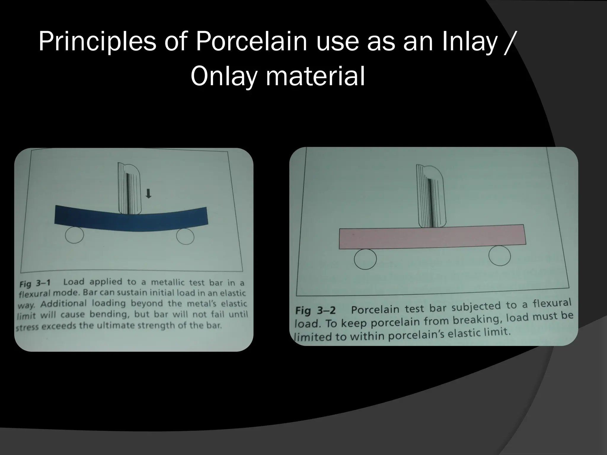 Principles of Porcelain use as an Inlay /
Onlay material
 