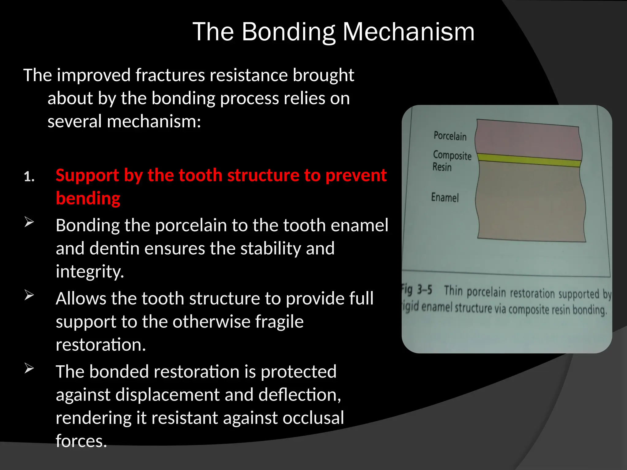 The Bonding Mechanism
The improved fractures resistance brought
about by the bonding process relies on
several mechanism:
1. Support by the tooth structure to prevent
bending
 Bonding the porcelain to the tooth enamel
and dentin ensures the stability and
integrity.
 Allows the tooth structure to provide full
support to the otherwise fragile
restoration.
 The bonded restoration is protected
against displacement and deflection,
rendering it resistant against occlusal
forces.
 