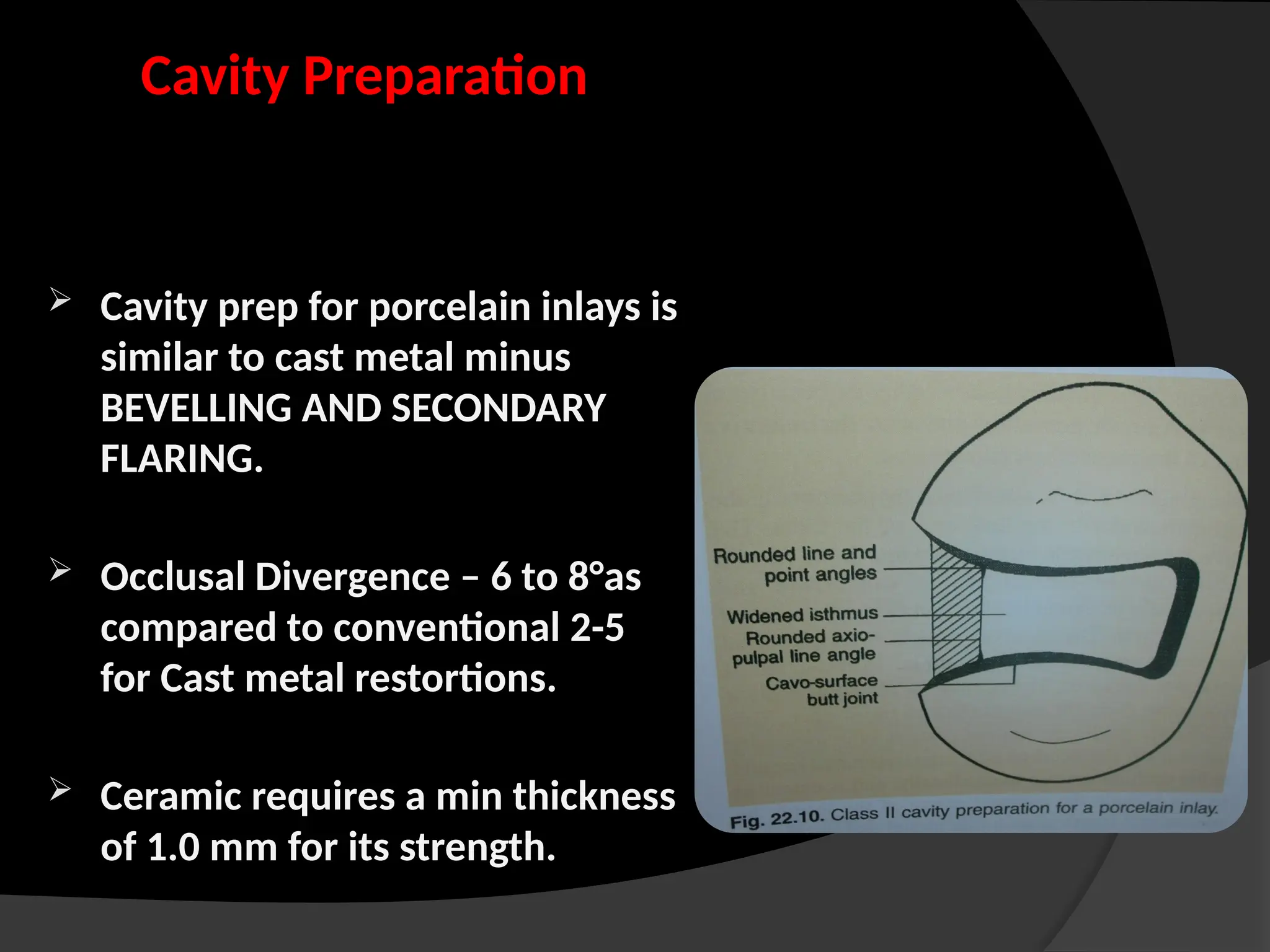 Cavity Preparation
 Cavity prep for porcelain inlays is
similar to cast metal minus
BEVELLING AND SECONDARY
FLARING.
 Occlusal Divergence – 6 to 8°as
compared to conventional 2-5
for Cast metal restortions.
 Ceramic requires a min thickness
of 1.0 mm for its strength.
 