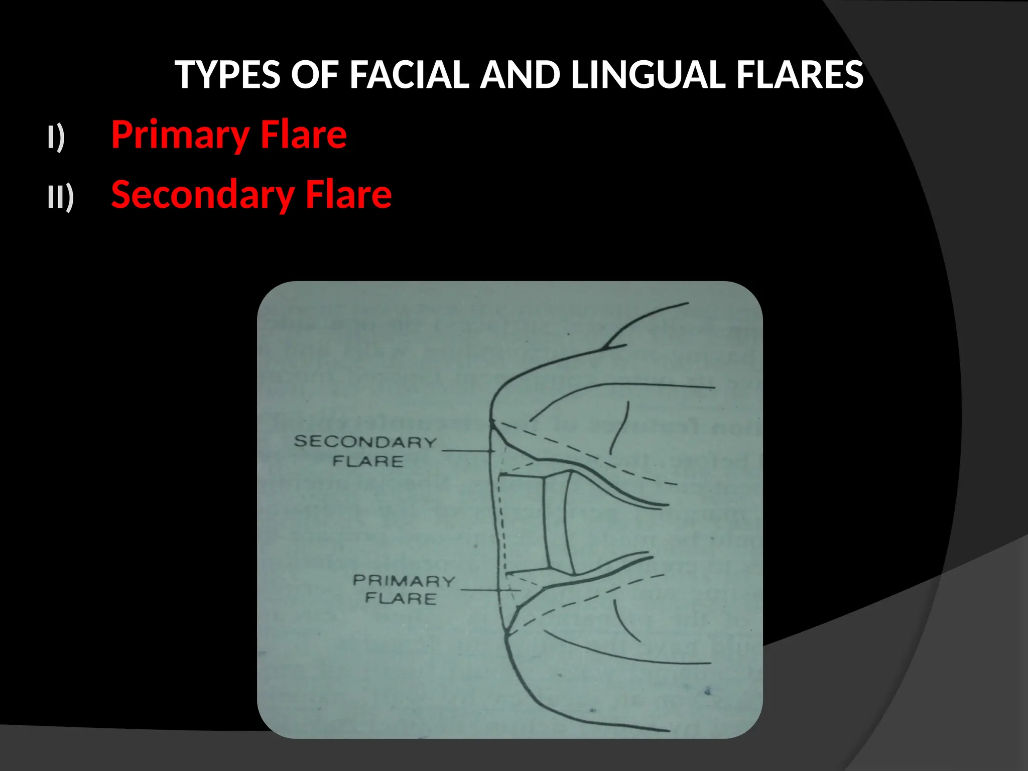 TYPES OF FACIAL AND LINGUAL FLARES
I) Primary Flare
II) Secondary Flare
 