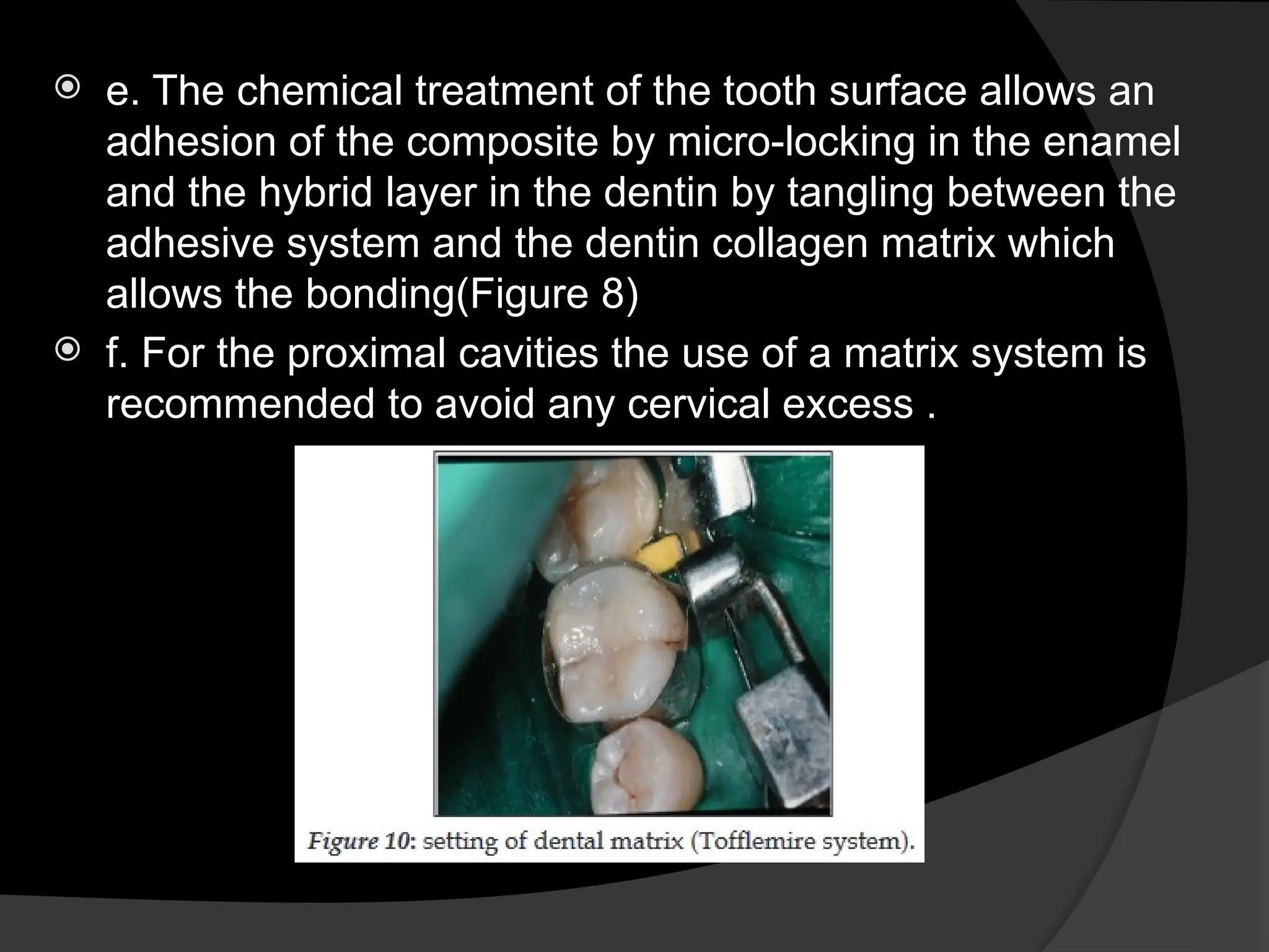 e. The chemical treatment of the tooth surface allows an
adhesion of the composite by micro-locking in the enamel
and the hybrid layer in the dentin by tangling between the
adhesive system and the dentin collagen matrix which
allows the bonding(Figure 8)
 f. For the proximal cavities the use of a matrix system is
recommended to avoid any cervical excess .
 