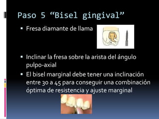 Inlays (Incrustaciones) | PPTX