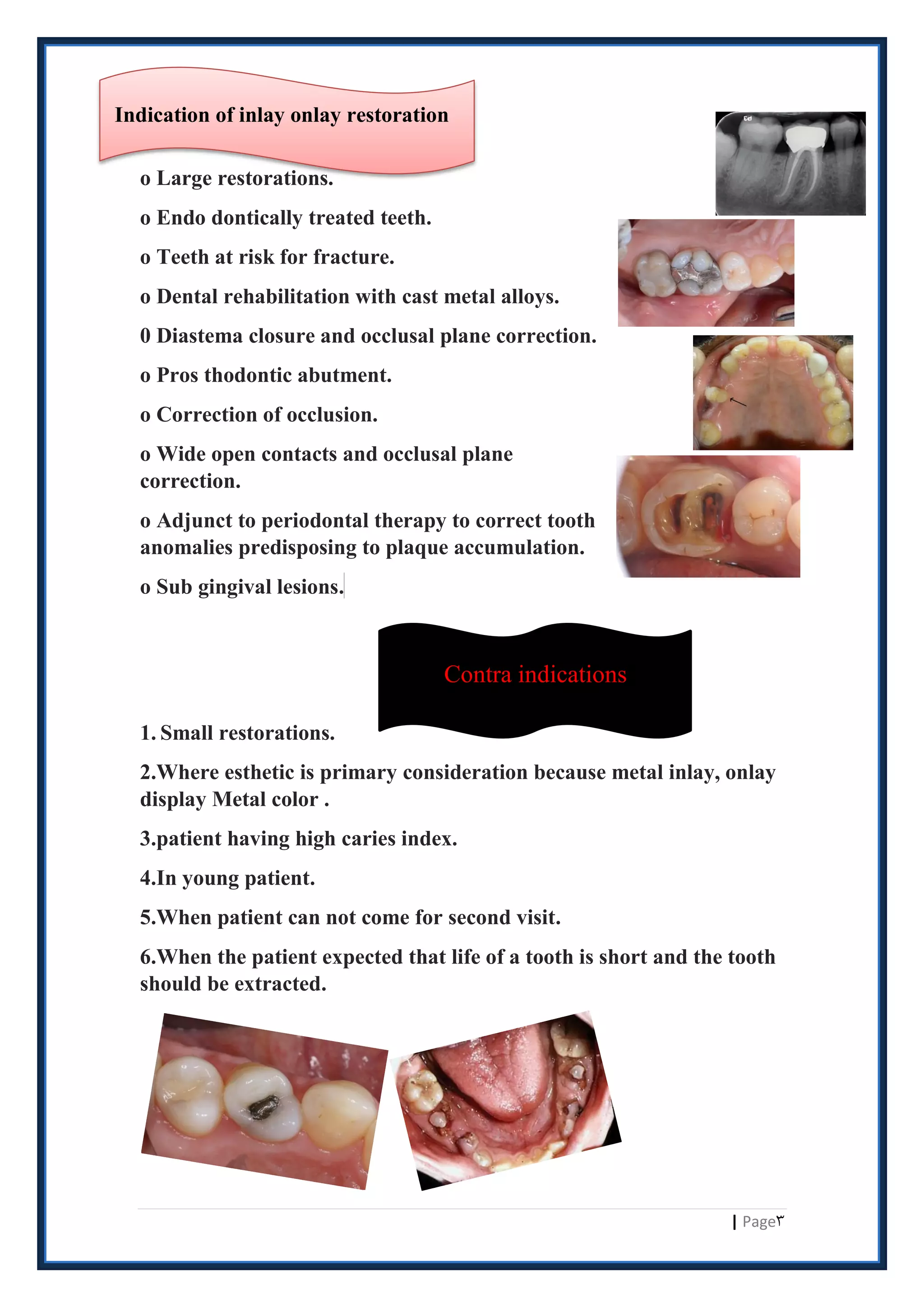 Inlays & onlays (crown and bridge ) | PDF