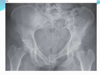 inlet and outlet.pptx | Blood Disorders | Diseases and Conditions