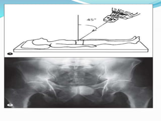 inlet and outlet.pptx | Blood Disorders | Diseases and Conditions
