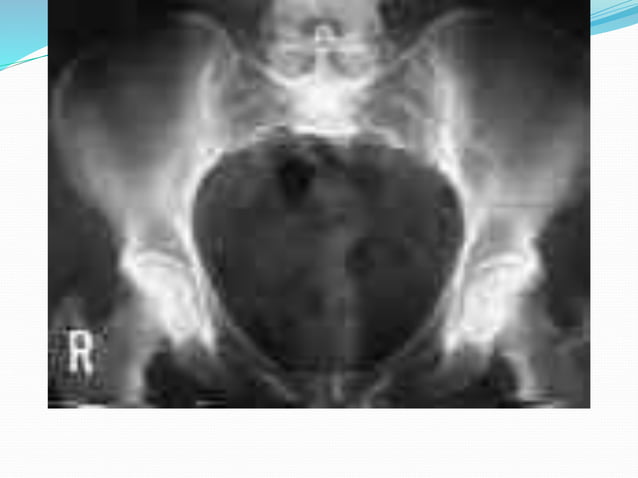 inlet and outlet.pptx | Blood Disorders | Diseases and Conditions