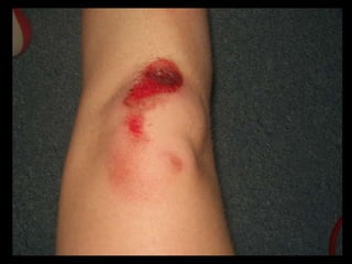 My Own Skating Pictures: