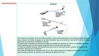 ATRICLIP
Este sistema de exclusión de la auriculilla izquierda, ocluye permanentemente la auriculilla izquierda desde su
base, evitando la entrada de sangre en la bolsa trabecular que es la fuente de más del 95% de los trombos
detectados en pacientes con fibrilación auricular.
El sistema está compuesto por dos tubos paralelos conectados por alambres de nitinol. Los alambres de nitinol
están diseñados para inducir la presión apropiada para la oclusión de la estructura.
Un tejido de poliéster trenzado, está diseñado para promover el crecimiento tisular y prevenir el migración del
dispositivo después de su colocación.
Hay cuatro (4) longitudes de dispositivo (35, 40, 45, 50). Independiente de la longitud del dispositivo, cada uno
genera la misma presión de clampeo a una distancia de apertura de 2mm
 