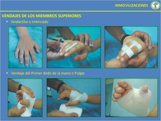 inmovilizaciones-pdf