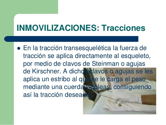 Los balanceos con los pequeños miembros