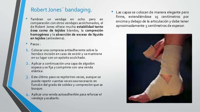 Inmovilizaciones en ortopedia. generalidades.