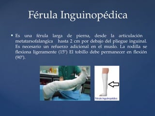 Femula Comprehensive Guide to Immobilization Techniques and Materials in ...