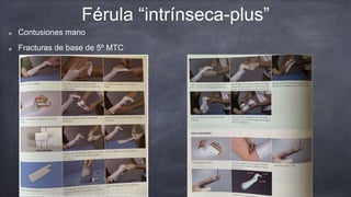 Inmovilizaciones en trauma | PPTX