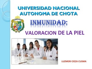 UNIVERSIDAD NACIONALUNIVERSIDAD NACIONAL
AUTONOMA DE CHOTAAUTONOMA DE CHOTA
VALORACION DE LA PIEL
LUZMERI CIEZA CUSMA
 