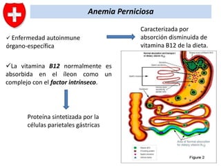 Anemia Perniciosa
 Enfermedad autoinmune

órgano-específica
La vitamina B12 normalmente es
absorbida en el íleon como un
complejo con el factor intrínseco.

Proteína sintetizada por la
células parietales gástricas

Caracterizada por
absorción disminuida de
vitamina B12 de la dieta.

 