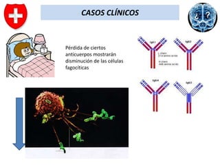 CASOS CLÍNICOS

Pérdida de ciertos
anticuerpos mostrarán
disminución de las células
fagocíticas

 