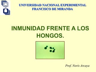 INMUNIDAD FRENTE A LOS
HONGOS.
Prof. Noris Arcaya
UNIVERSIDAD NACIONAL EXPERIMENTAL
FRANCISCO DE MIRANDA
 