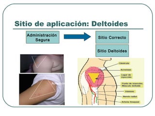Sitio de aplicación: Deltoides
Administración
Administración
Segura
Segura

Sitio Correcto
Sitio Correcto
Sitio Deltoides
Sitio Deltoides

 