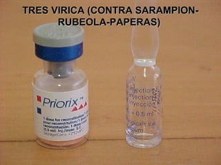 TRES VIRICA (CONTRA SARAMPION-
      RUBEOLA-PAPERAS)
 