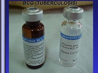 BCG (TUBERCULOSIS)
 