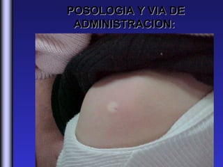 POSOLOGIA Y VIA DE
 ADMINISTRACION:
 
