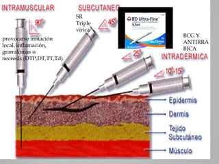 SR
                           Triple
                           virica
                                    BCG Y
provocarse irritación
                                    ANTIRRA
local, inflamación,
                                    BICA
granulomas o
necrosis (DTP,DT,TT,Td).
 