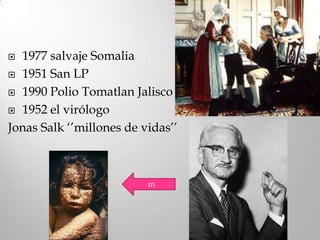  1977 salvaje Somalia
 1951 San LP

 1990 Polio Tomatlan Jalisco

 1952 el virólogo

Jonas Salk ‘’millones de vidas’’



                          m
 