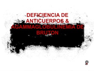 DEFICIENCIA DE ANTICUERPOS & AGAMMAGLOBULINEMIA DE BRUTON 