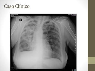 Caso Clínico
 