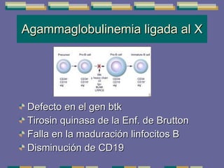 Agammaglobulinemia ligada al X Defecto en el gen btk Tirosin quinasa de la Enf. de Brutton Falla en la maduración linfocitos B Disminución de CD19 