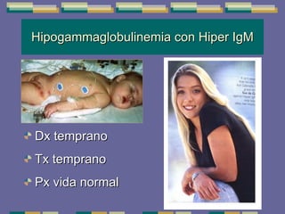 Hipogammaglobulinemia con Hiper IgM Dx temprano Tx temprano Px vida normal 