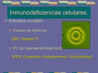 Inmunodeficiencias celulares. Estudios iniciales  : Cuenta de linfocitos  (BH, rosetas T) PC de hipersensibilidad tardía   (PPD, Candidina, Histoplasmina, Coccidiodina)   
