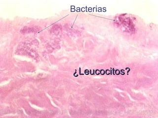 Bacterias ¿Leucocitos? 