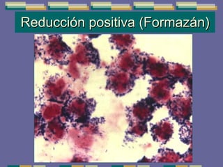 Reducción positiva (Formazán) 