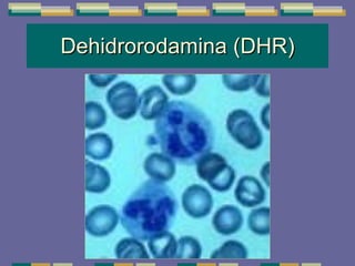 Dehidrorodamina (DHR) 
