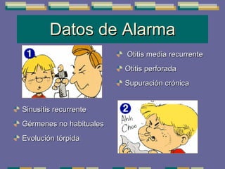 Datos de Alarma Sinusitis recurrente Gérmenes no habituales Evolución tórpida Otitis media recurrente Otitis perforada Supuración crónica 