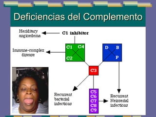 Deficiencias del Complemento 