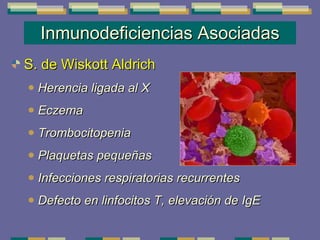 Inmunodeficiencias Asociadas S. de Wiskott Aldrich Herencia ligada al X  Eczema  Trombocitopenia  Plaquetas pequeñas Infecciones respiratorias recurrentes Defecto en linfocitos T, elevación de IgE 