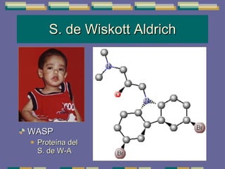 S. de Wiskott Aldrich WASP Proteína del S. de W-A 