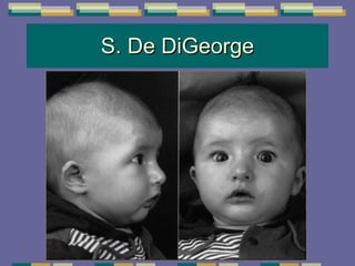 S. De DiGeorge 