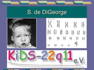 S. de DiGeorge 