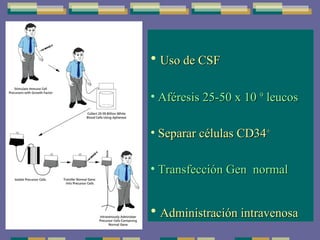 Uso de CSF Aféresis 25-50 x 10  9  leucos Separar células CD34 + Transfección Gen  normal Administración intravenosa 