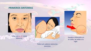 PRIMEROS SINTOMAS
Fatiga aguda sin causa
aparente
Fiebre y/o sudores nocturnos
excesivos
Ganglios inflamados en
el cuello, las axilas o la
ingle.
 