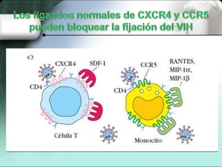 Inmunodeficiencias secundaria (SIDA)