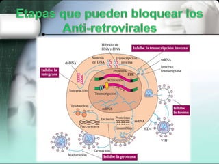 Inmunodeficiencias secundaria (SIDA)