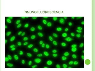 Inmunofluorescencia 