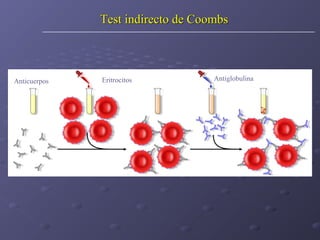 Test indirecto de Coombs

Anticuerpos

Eritrocitos

Antiglobulina

 