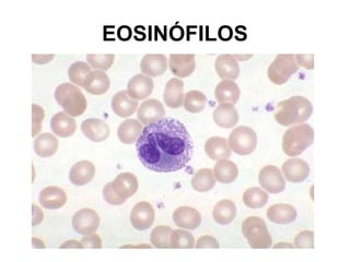 EOSINÓFILOS
 