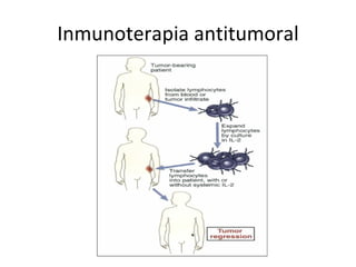 Inmunoterapia antitumoral